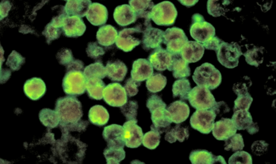 미국 뇌 먹는 아메바 네글레리아 파울러리