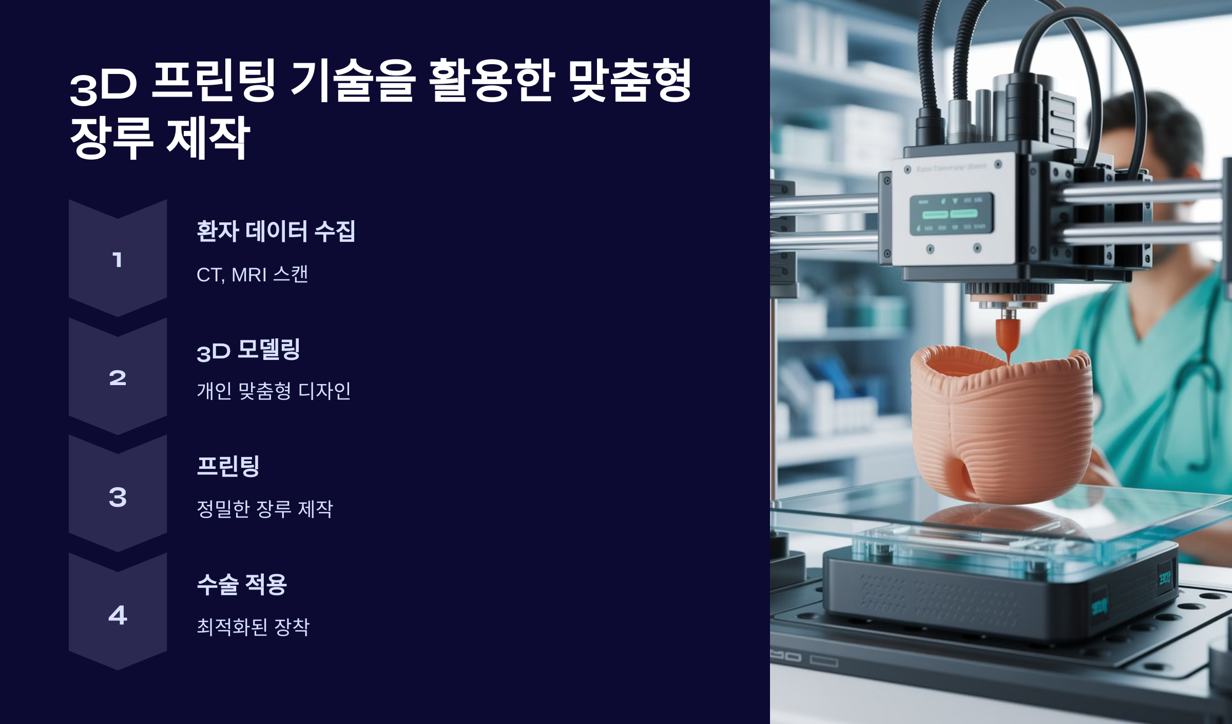 3D프린팅