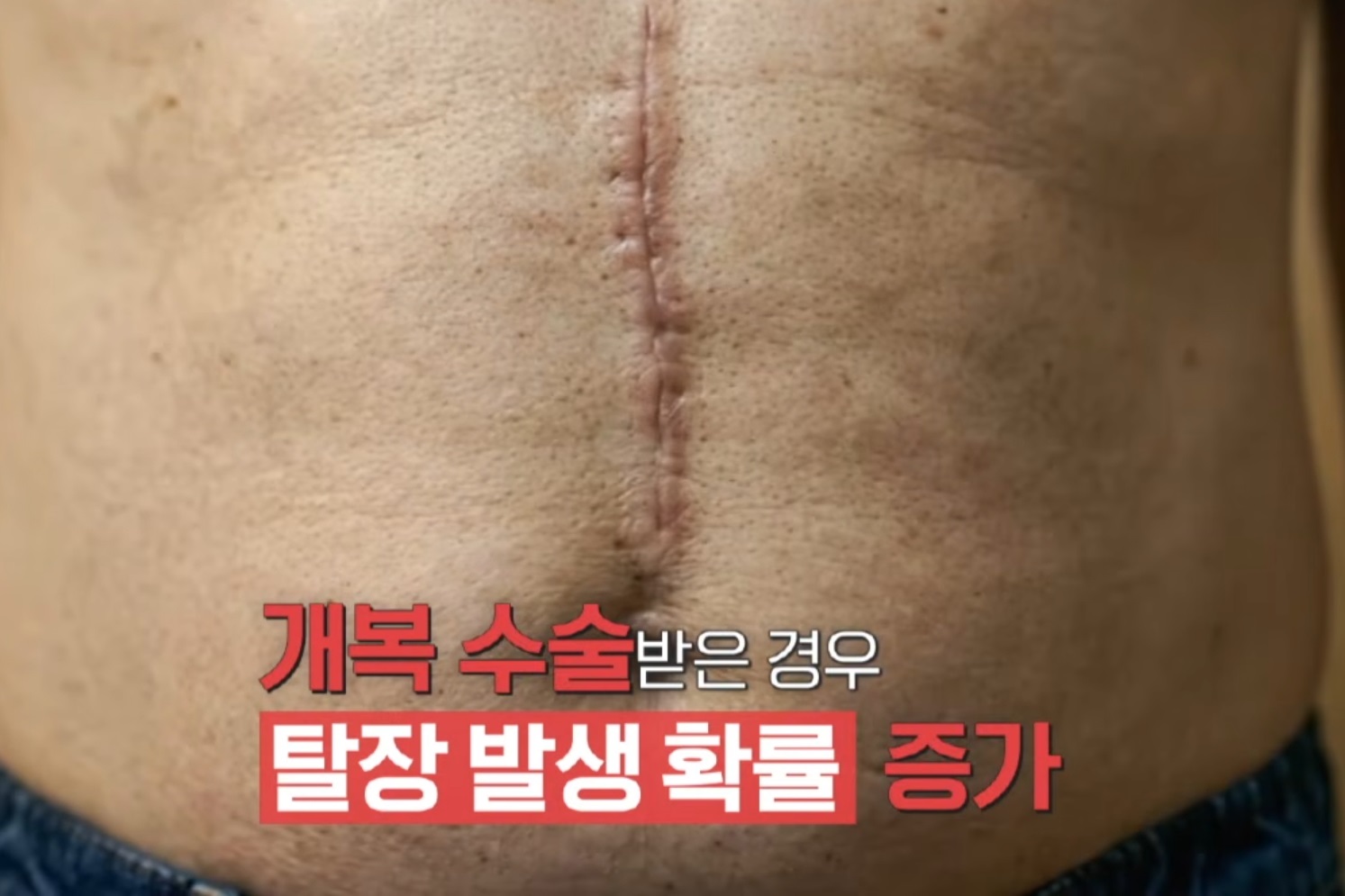 명의-하태경-교수