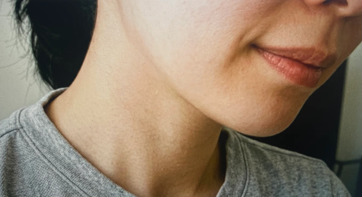 더시드 모공픽서 내돈내산 후기 증명사진