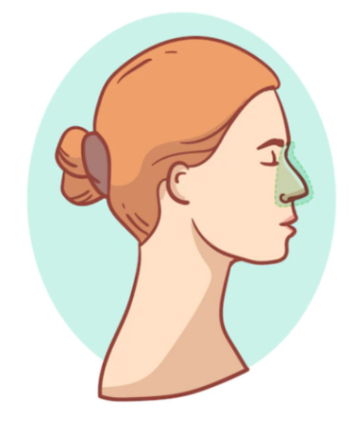 슈다페드정 효능