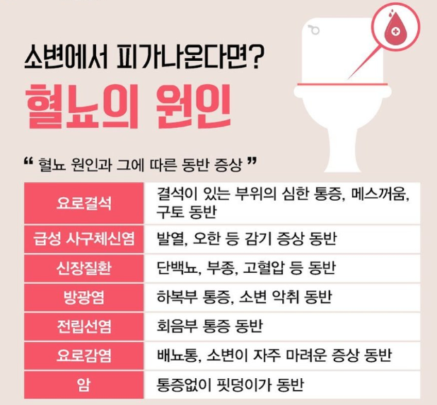 혈뇨가 나오는 이유 1