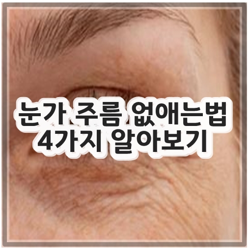눈가 주름 없애는법 4가지 알아보기