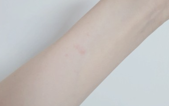 글루타민의 효능 효과와 L -글루타민 그리고 글루타민의 부작용