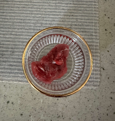 소고기