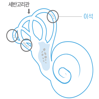 이석