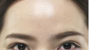 이마
