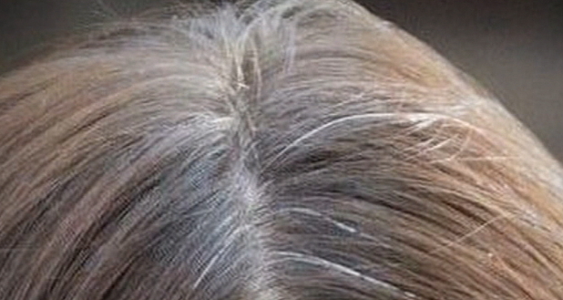 흰머리 나는 이유