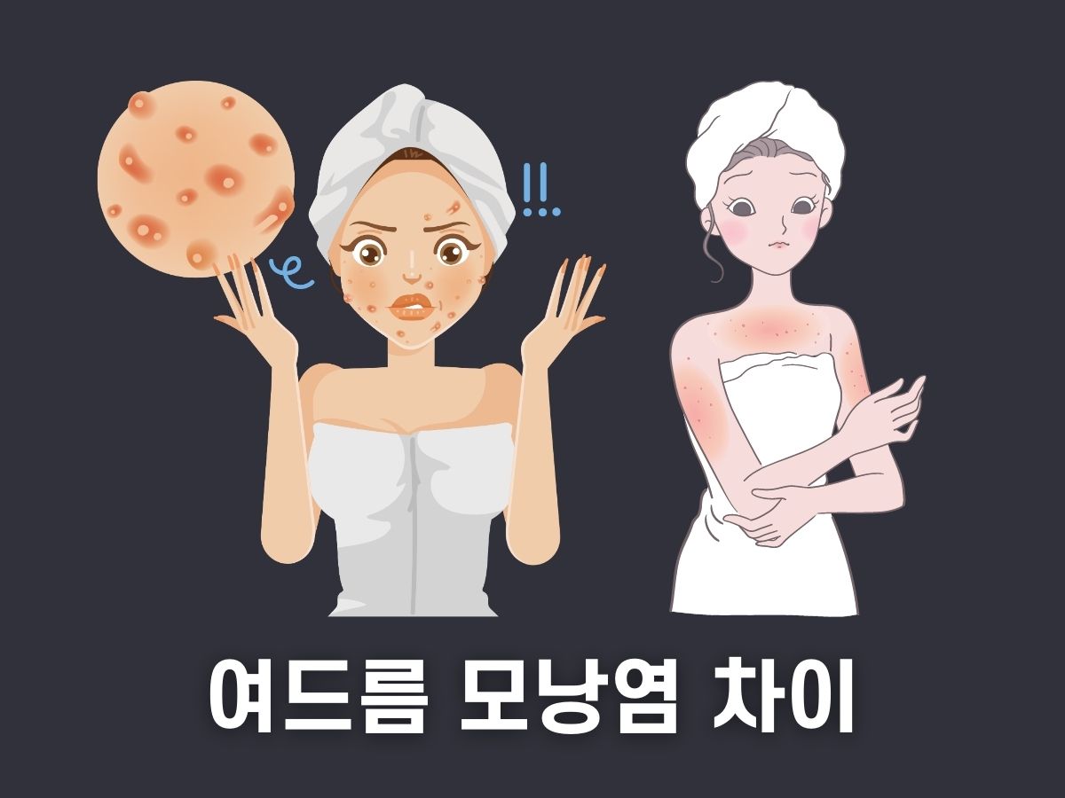 여드름 모낭염 차이