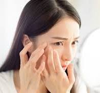 비립종 없애는 방법