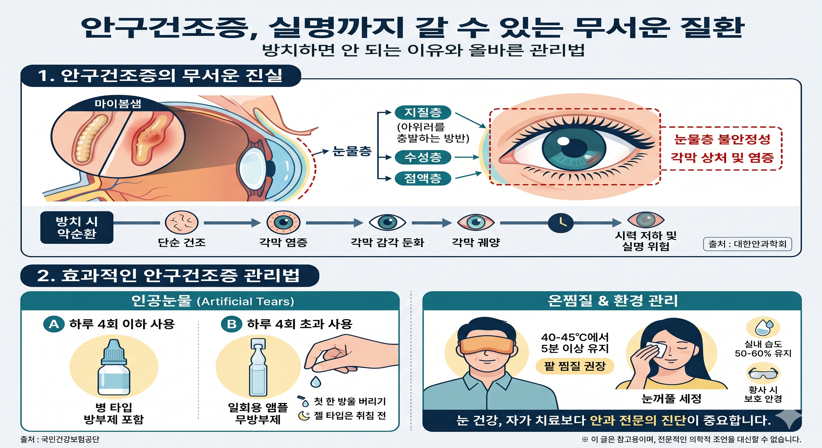 안구건조증