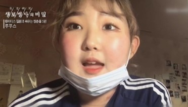 루푸스병 이란 최준희 루푸스 증상 진단 검사 치료 방법 정리