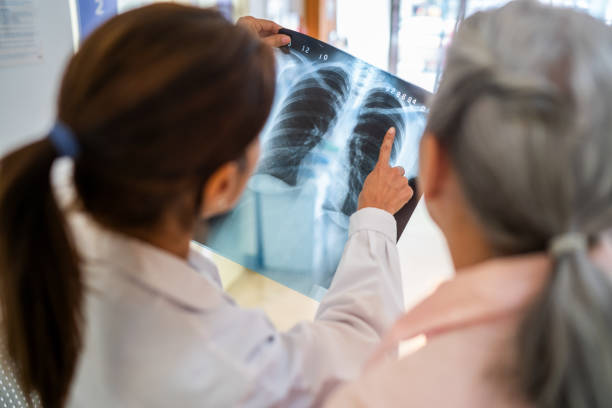 폐섬유증은 폐의 정상적인 조직이 염증과 흉터 조직으로 대체되며 점차 굳어지는 질환