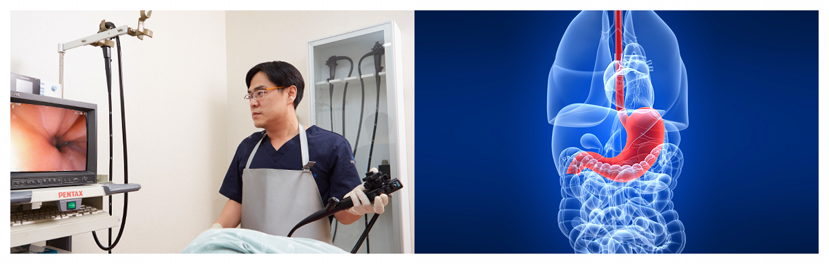 위내시경-금식시간