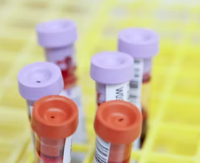 빈혈 치료방법 진단기준 합병증