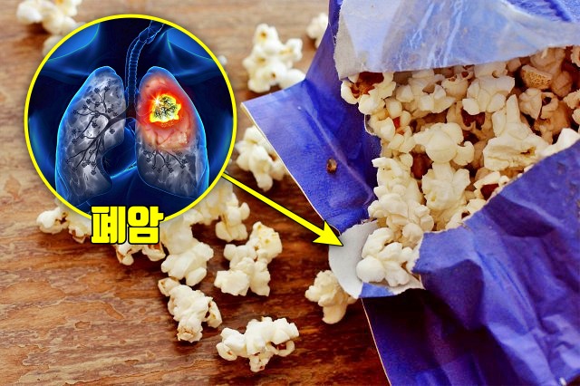 암이 좋아하는 음식,팝콘 암유발 음식
