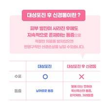 대상포진 초기증상
