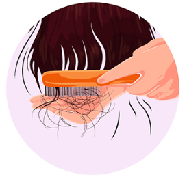 휴지기 탈모의 예시, 한번에 많이 빠진다. 원인은 스트레스가 대부분이다.