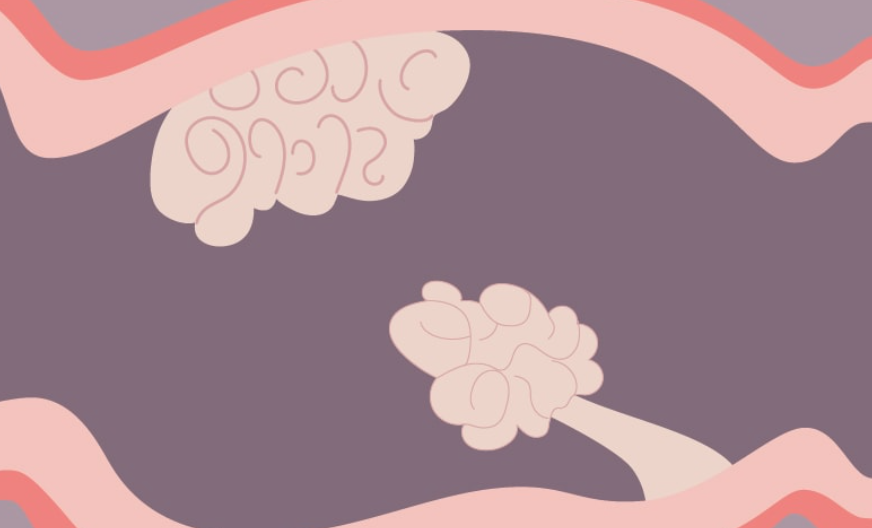 과민성 대장증후군