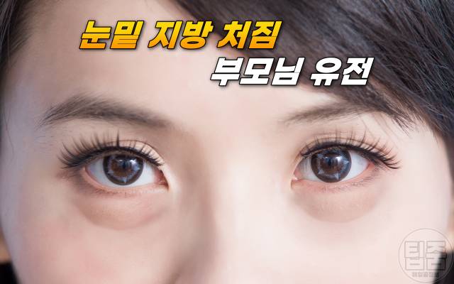 다크서클 원인 아이크림 추천 눈밑처짐 눈밑지방