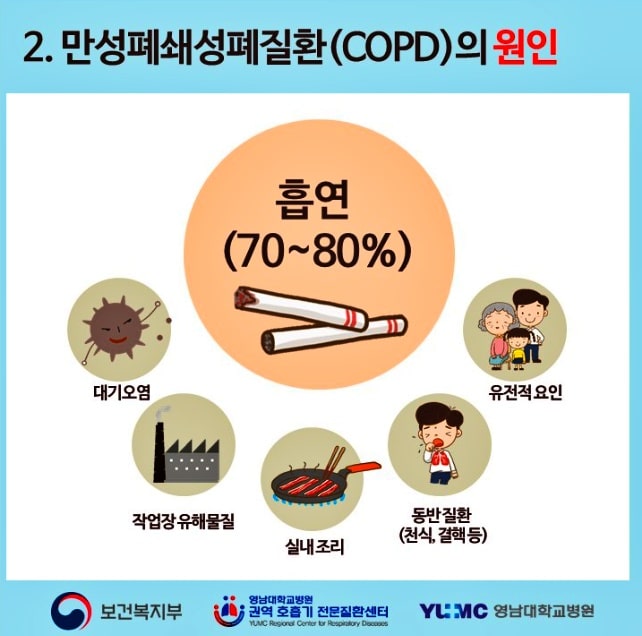 만성-폐쇄성-폐질환