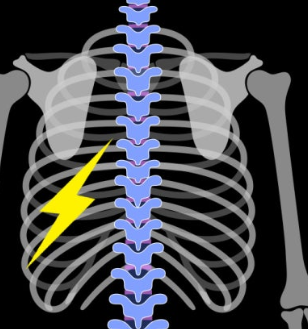 갈비뼈 금간 증상 2
