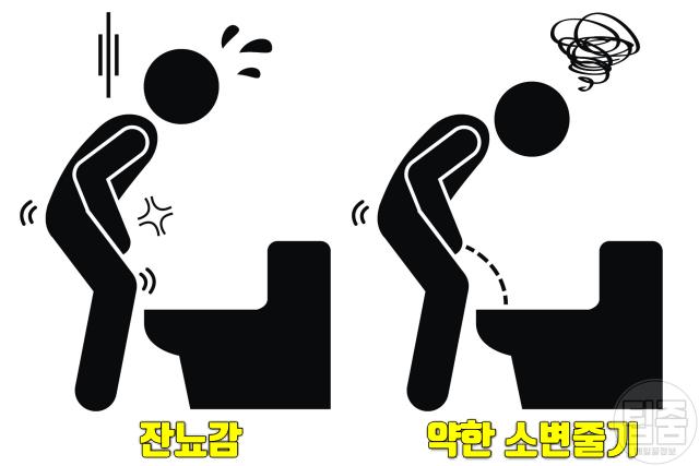 전립선 안좋을때 증상 소변줄기