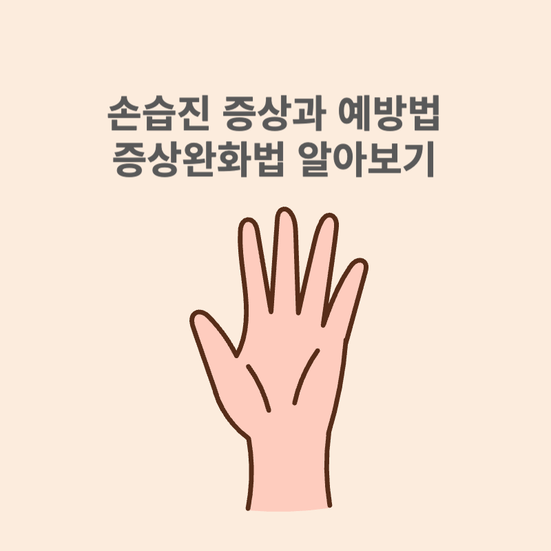 손습진 증상과 예방법 증상완화법 알아보기