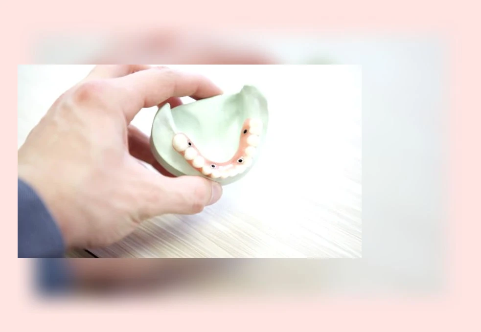 20대 여성 치아 관리_4