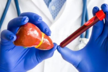 감마지티피-사진2