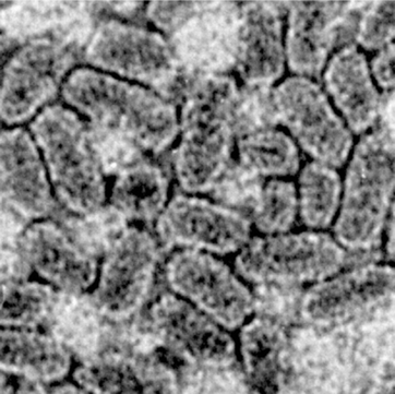 올리아바이러스