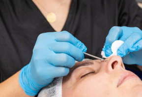 블랙헤드 피부과