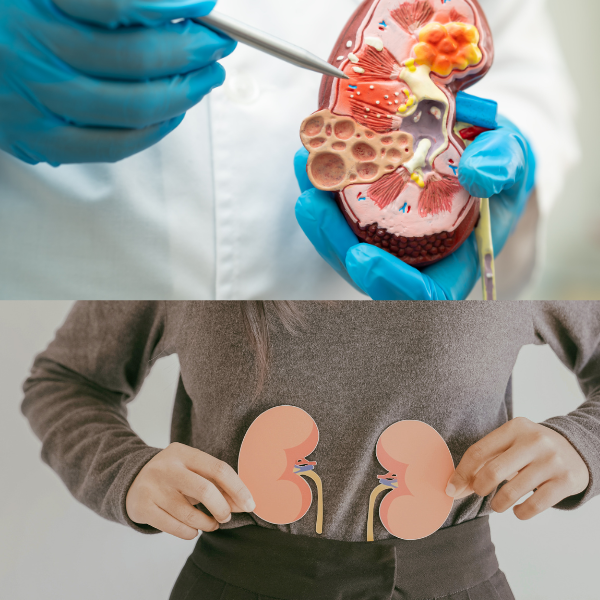 칼슘 과다 부작용