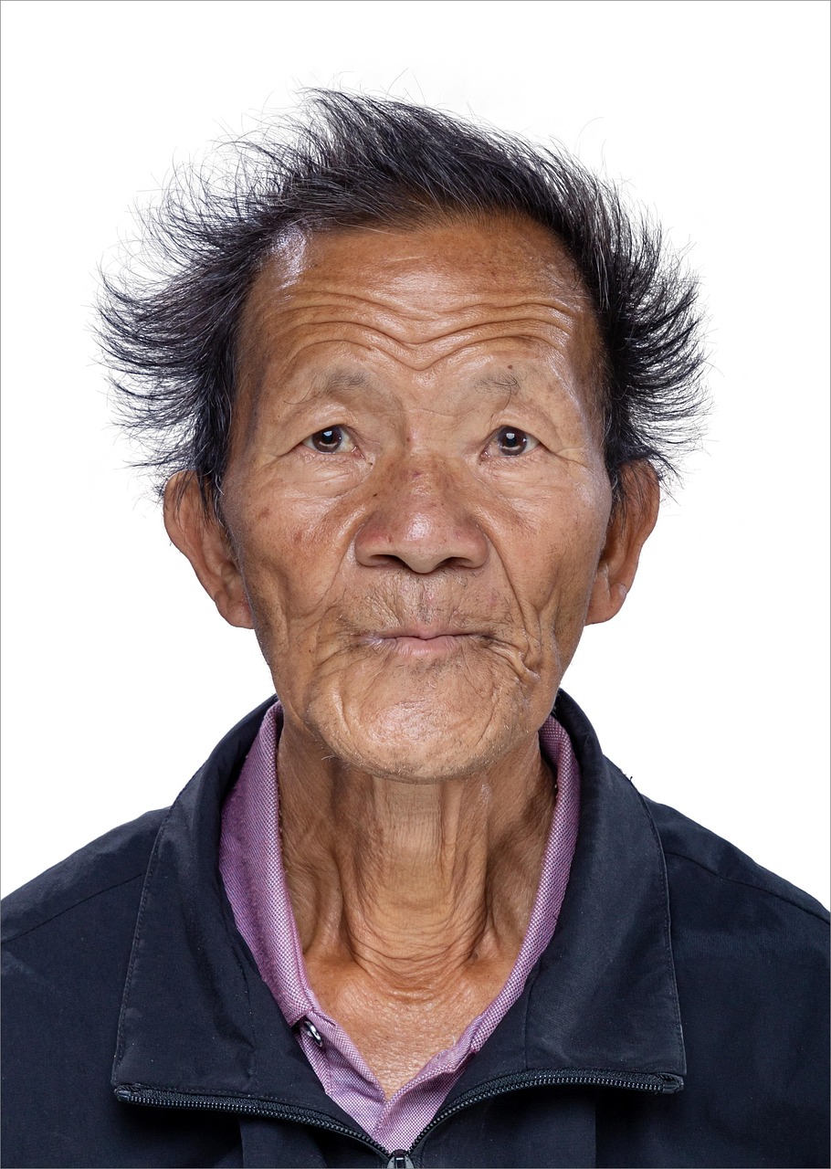 보톡스 내성 발생