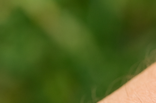 쯔쯔가무시 진드기 물린 자국