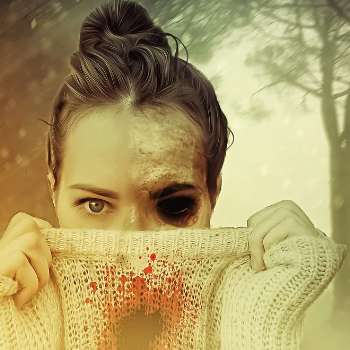 연쇄상구균독성쇼크증후군(STSS)증상