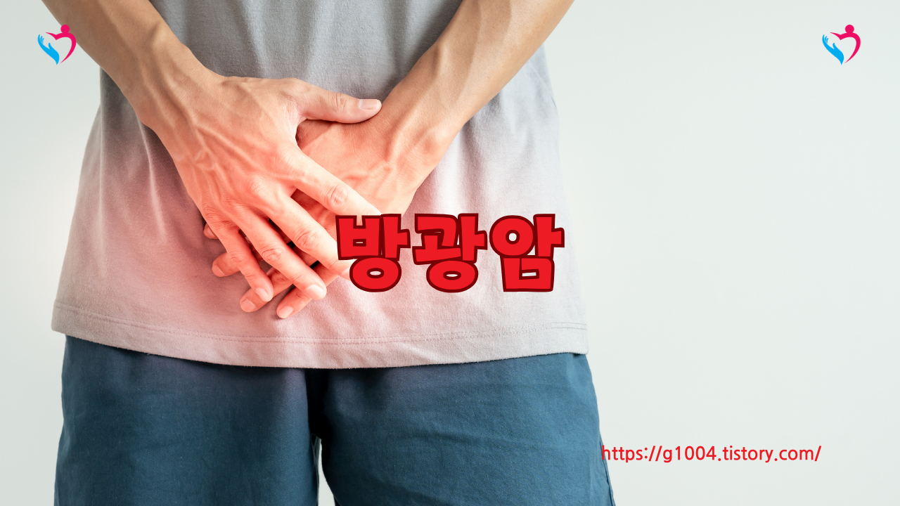 방광암