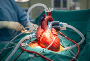 혈관조영술 검사원리