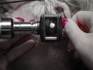 난청 정부 지원금 장애등급 치료 난청 지원금