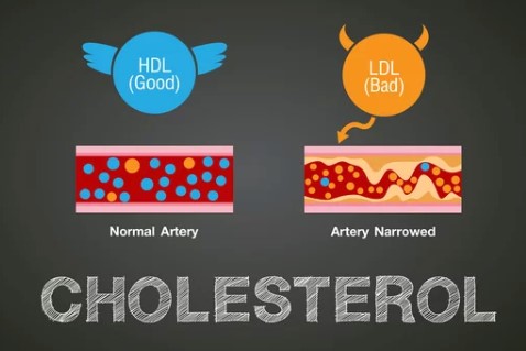폴리코사놀 효능, 사탕수수가 중요한 이유, 나이가 들어 감에 따라 각종 질병에 노출되어 고혈압, 당뇨 등의 대사증후군을 일으키고 뇌심혈관질환으로 이어지게 됩니다.