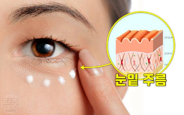얼굴 노화 증상,피부노화 증상,눈밑주름 보톡스