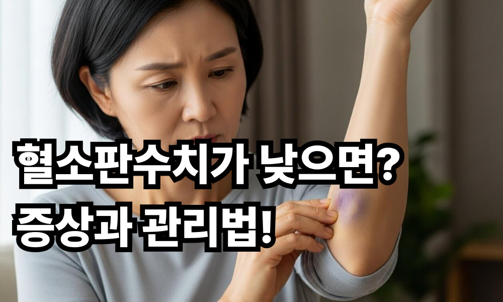 혈소판수치가 낮으면 증상 관리법 사진 1