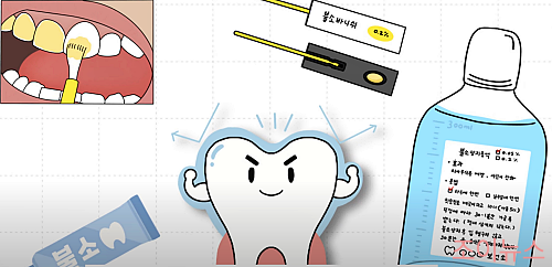 불소 도포란? _이미지출처: 임플란티아TV