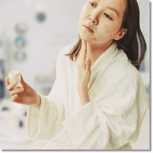 만성 콩팥병 증상, 전신 부기 얼굴이 퉁퉁 부은 여성