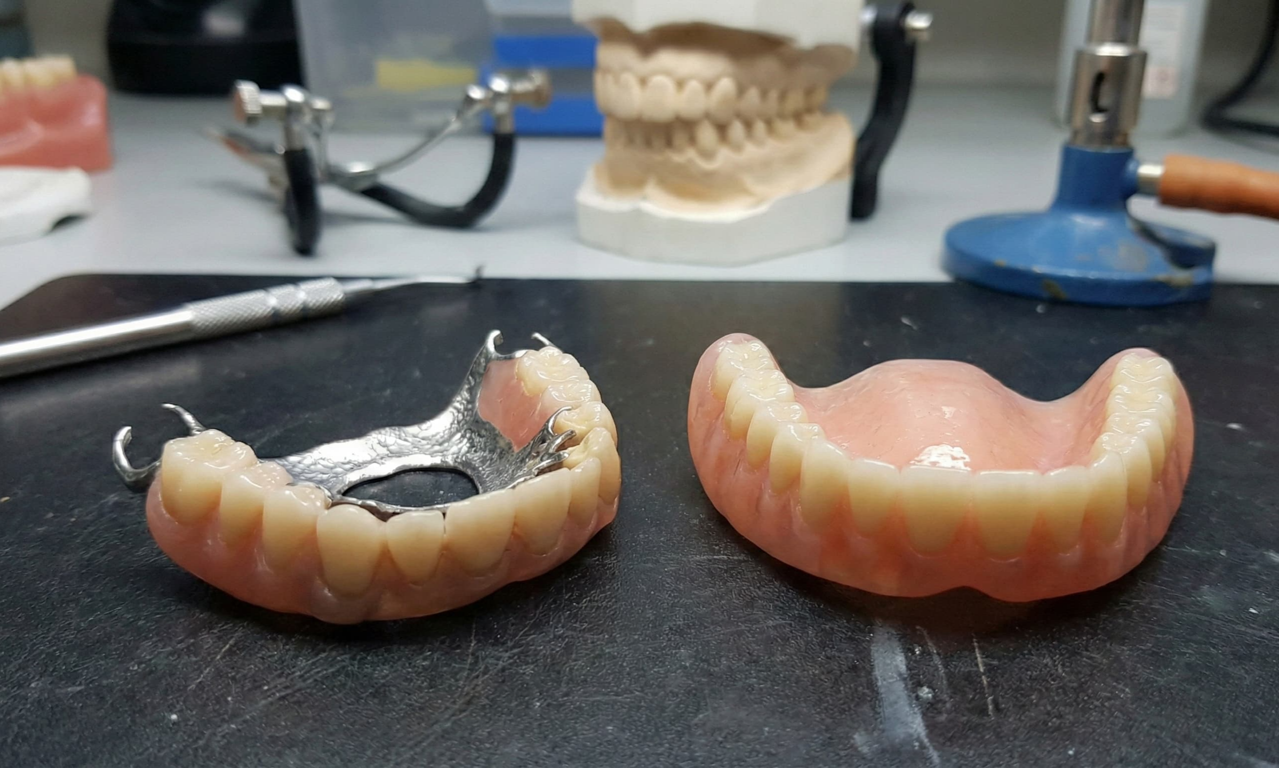 부분틀니 vs 전체틀니