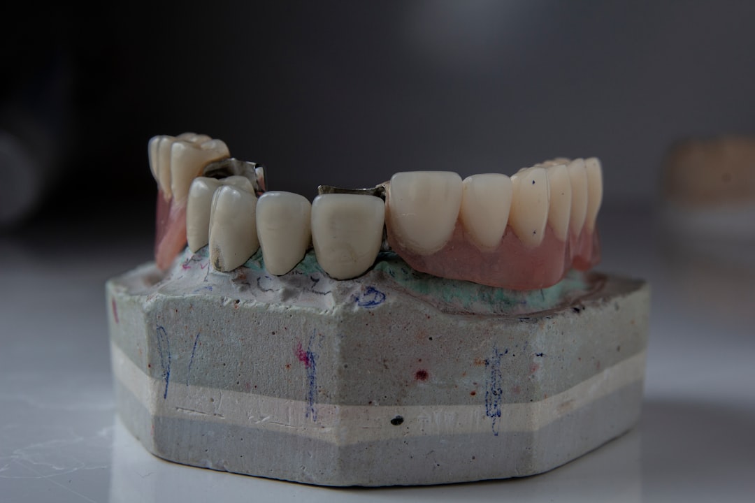 Dental 치료 (Dental Treatment)