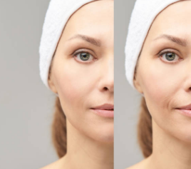 글루타치온 효능&amp;#44; 부작용&amp;#44; 많이든 음식 총정리 (2025ver)