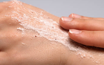 겨울철 피부관리