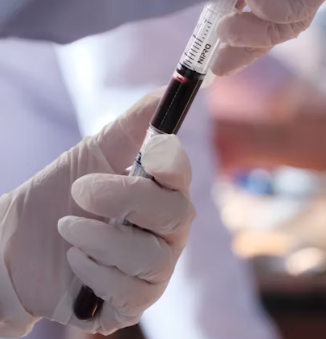 빈혈 치료방법 진단기준 합병증