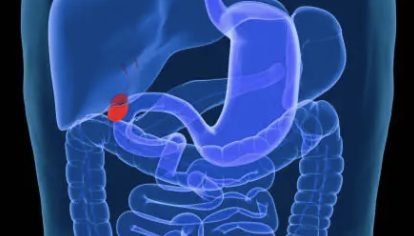 백혈병 초기증상 30